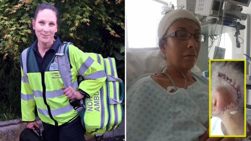 three photos. Far left Sara in her CFR high-vis uniform and a kit bag. Right photo Sara in a hospital bed with a bandage round her head and tubes coming out of her chest. Bottom right photo is of her incision, a c shape around her ear on her head.